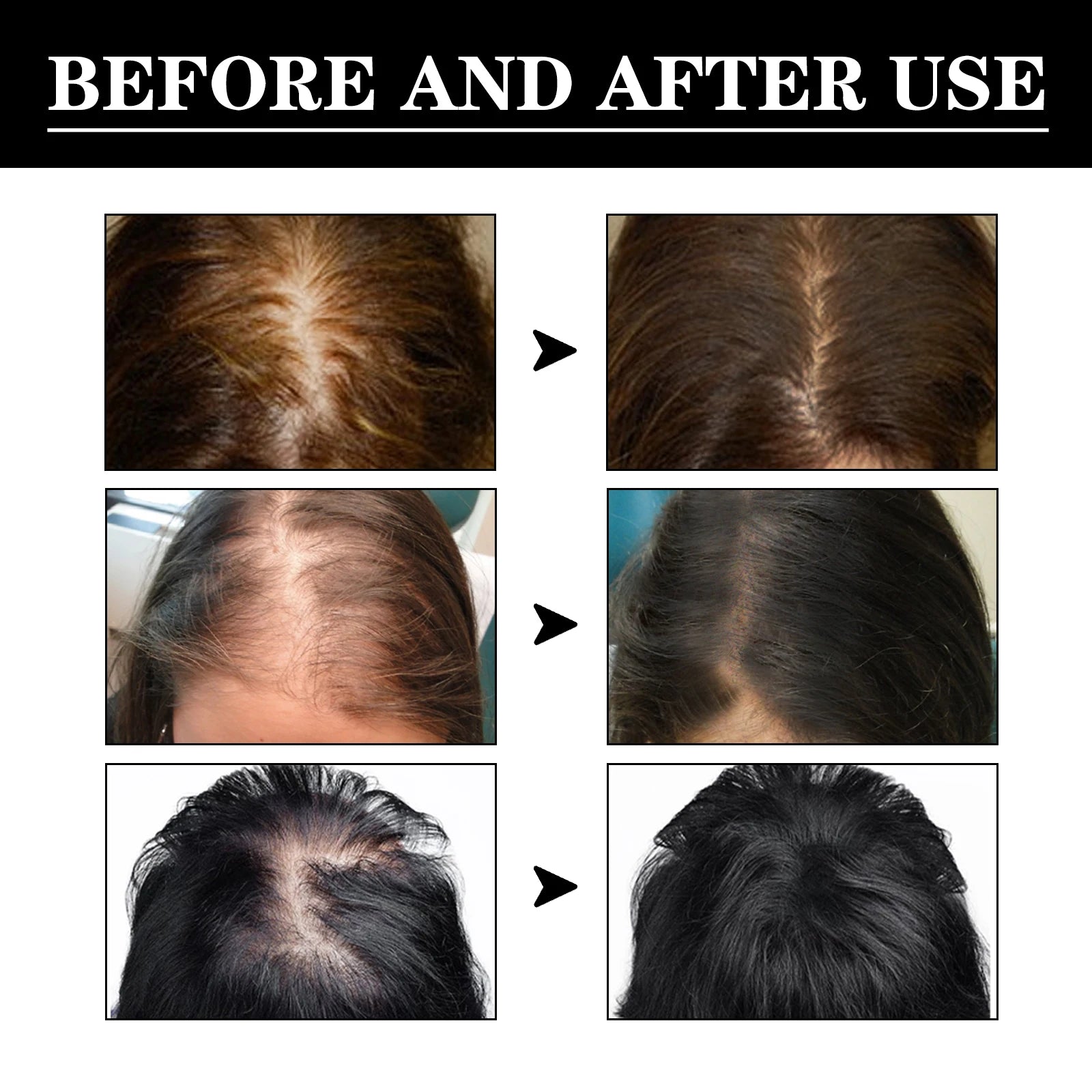 Hair care essence has good permeability penetrates into the hair core fully absorbs nutrients deeply moisturizes Gentle smooth